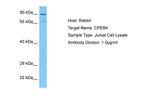 CPEB4 Antibody in Western Blot (WB)