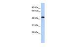 Creatine Kinase MB Antibody in Western Blot (WB)