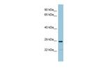 NAT8B Antibody in Western Blot (WB)