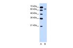 Cytokeratin 2e Antibody in Western Blot (WB)