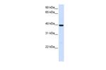 Alcohol Dehydrogenase 1A Antibody in Western Blot (WB)