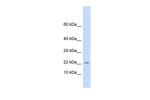 CRF Antibody in Western Blot (WB)