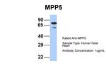 MPP5 Antibody in Western Blot (WB)