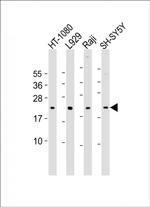 Bax Antibody in Western Blot (WB)