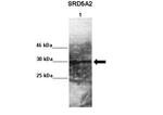 SRD5A2 Antibody in Western Blot (WB)