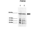 PSEN2 Antibody in Western Blot (WB)