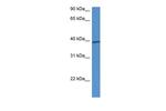 CALHM1 Antibody in Western Blot (WB)