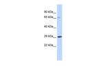 FceR1 alpha Antibody in Western Blot (WB)