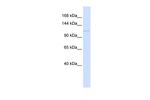 PTCH2 Antibody in Western Blot (WB)