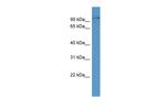 alpha Dystroglycan Antibody in Western Blot (WB)