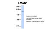 LMAN1 Antibody in Western Blot (WB)