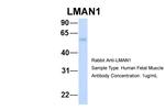 LMAN1 Antibody in Western Blot (WB)