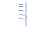 DULLARD Antibody in Western Blot (WB)