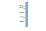 Lass6 Antibody in Western Blot (WB)