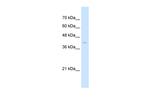 beta-Arrestin 2 Antibody in Western Blot (WB)