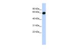 B3GALNT2 Antibody in Western Blot (WB)