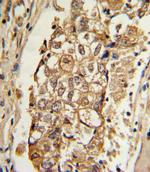 MCL-1 Antibody in Immunohistochemistry (Paraffin) (IHC (P))