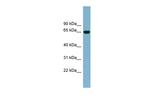 IL-22 Receptor alpha Antibody in Western Blot (WB)