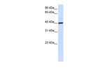 MOSC1 Antibody in Western Blot (WB)