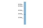 ARV1 Antibody in Western Blot (WB)