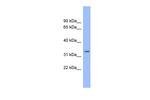 DDRGK1 Antibody in Western Blot (WB)