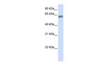 SLC47A2 Antibody in Western Blot (WB)