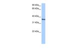 CHAD Antibody in Western Blot (WB)