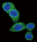 PUMA alpha Antibody in Immunocytochemistry (ICC/IF)