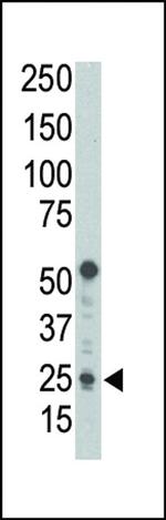 PUMA alpha Antibody in Western Blot (WB)