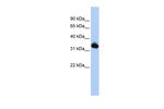 GALM Antibody in Western Blot (WB)