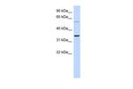 ASPRV1 Antibody in Western Blot (WB)