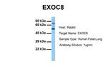 EXOC8 Antibody in Western Blot (WB)