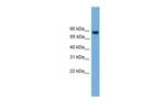 EXOC8 Antibody in Western Blot (WB)