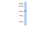 KLC3 Antibody in Western Blot (WB)