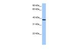 CK2 alpha-2 Antibody in Western Blot (WB)