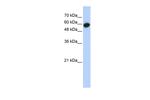 LRRC6 Antibody in Western Blot (WB)