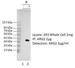 Arginase 2 Antibody in Immunoprecipitation (IP)