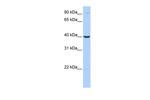 Arginase 2 Antibody in Western Blot (WB)