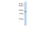 FBXO8 Antibody in Western Blot (WB)