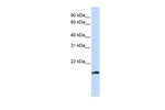 Pallidin Antibody in Western Blot (WB)