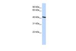 TMOD3 Antibody in Western Blot (WB)