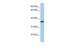 LDLRAP1 Antibody in Western Blot (WB)