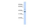 MMADHC Antibody in Western Blot (WB)