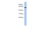 LEMD2 Antibody in Western Blot (WB)