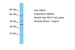 MATN2 Antibody in Western Blot (WB)