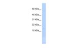 MYL6 Antibody in Western Blot (WB)