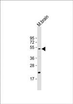 HTRA1 Antibody in Western Blot (WB)