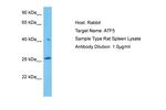 ATF5 Antibody in Western Blot (WB)