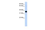 AIP Antibody in Western Blot (WB)