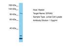 EphA5 Antibody in Western Blot (WB)